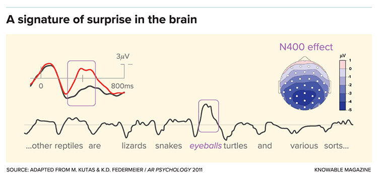 A surprise in the brain graphic