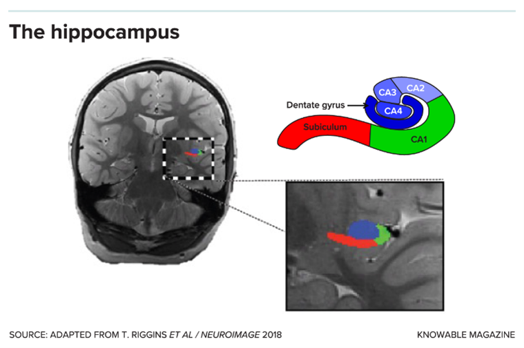 Graphic of the hippocampus