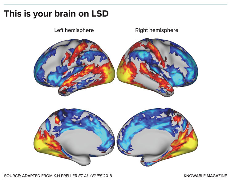Brain on LSD graphic