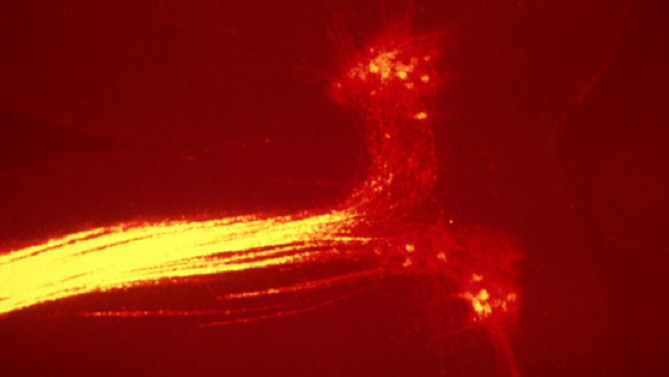Image of motor neurons in eye