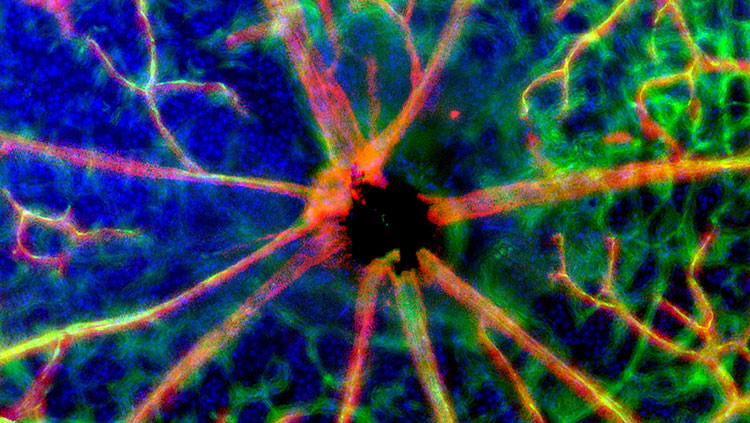 blood vessels and nerves at the optic disk